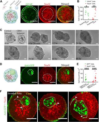3D models of glioblastoma interaction with cortical cells